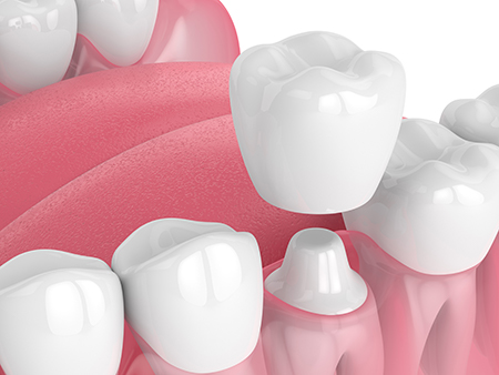Berchelmann Family Dental